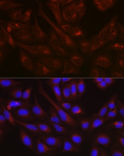 Invitrogen NSF Polyclonal Antibody 100 &mu;L | Buy Online | Invitrogen&trade; | Fisher Scientific