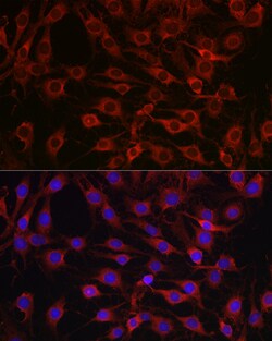 Invitrogen MARCKS Polyclonal Antibody 100 &mu;L; Unconjugated:Antibodies,