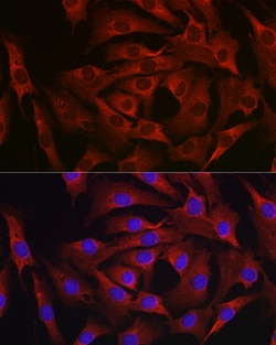 Invitrogen MARCKS Polyclonal Antibody 100 &mu;L; Unconjugated:Antibodies,