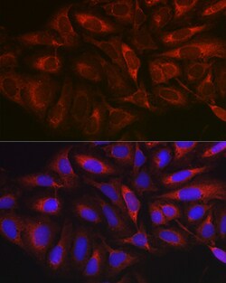 Invitrogen MARCKS Polyclonal Antibody 100 &mu;L; Unconjugated:Antibodies,