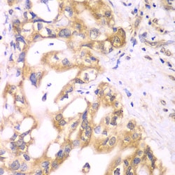 Invitrogen ACADS Polyclonal Antibody 100 &mu;L; Unconjugated:Antibodies,