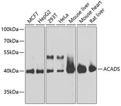 Invitrogen ACADS Polyclonal Antibody 100 &mu;L; Unconjugated:Antibodies,