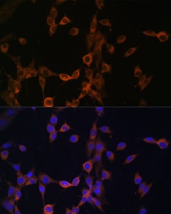 Invitrogen Calcineurin B Polyclonal Antibody 100 &mu;L; Unconjugated:Antibodies,