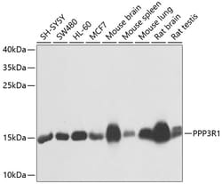 Invitrogen Calcineurin B Polyclonal Antibody 100 &mu;L; Unconjugated:Antibodies,