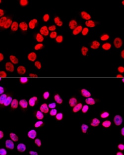 Invitrogen SFPQ Polyclonal Antibody 100 &mu;L; Unconjugated:Antibodies,