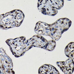 Invitrogen SFPQ Polyclonal Antibody 100 &mu;L; Unconjugated:Antibodies,