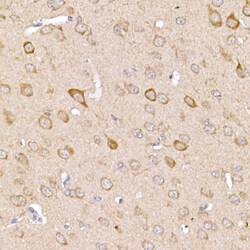 Invitrogen TRAF2 Polyclonal Antibody 100 &mu;L; Unconjugated:Antibodies,