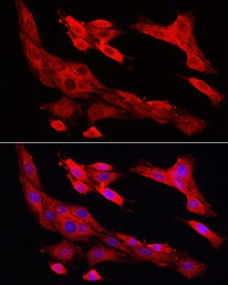 Invitrogen Caspase 1 Polyclonal Antibody 100 &mu;L; Unconjugated:Antibodies,