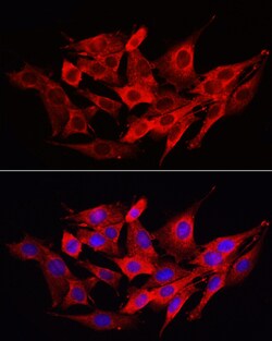 Invitrogen Caspase 1 Polyclonal Antibody 100 &mu;L; Unconjugated:Antibodies,