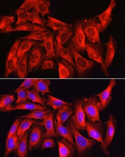 Invitrogen Caspase 1 Polyclonal Antibody 100 &mu;L; Unconjugated:Antibodies,