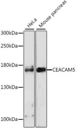 Invitrogen CEACAM5 Polyclonal Antibody 100 &mu;L | Buy Online | Invitrogen&trade; | Fisher Scientific