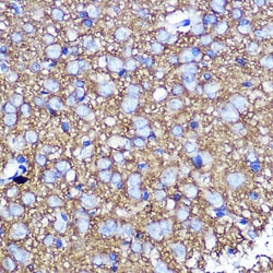 Invitrogen SNAP25 Polyclonal Antibody 100 &mu;L; Unconjugated:Antibodies,