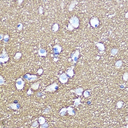 Invitrogen SNAP25 Polyclonal Antibody 100 &mu;L; Unconjugated:Antibodies,