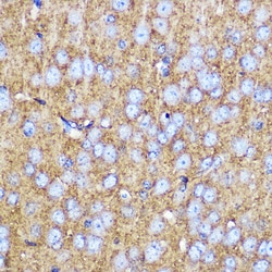 Invitrogen SNAP25 Polyclonal Antibody 100 &mu;L; Unconjugated:Antibodies,
