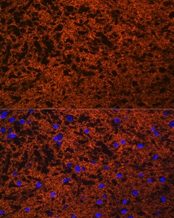 Invitrogen SNAP25 Polyclonal Antibody 100 &mu;L; Unconjugated:Antibodies,