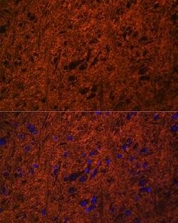 Invitrogen SNAP25 Polyclonal Antibody 100 &mu;L; Unconjugated:Antibodies,