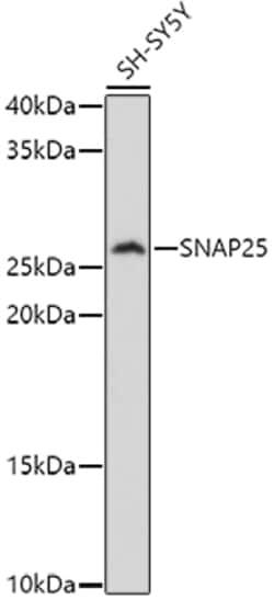 Invitrogen SNAP25 Polyclonal Antibody 100 &mu;L; Unconjugated:Antibodies,