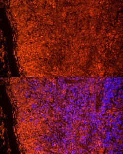 Invitrogen TLR7 Polyclonal Antibody 100 &mu;L; Unconjugated:Antibodies,