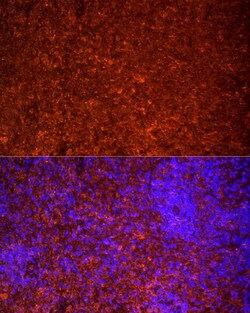 Invitrogen TLR7 Polyclonal Antibody 100 &mu;L; Unconjugated:Antibodies,