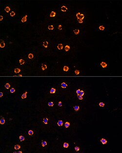 Invitrogen TLR7 Polyclonal Antibody 100 &mu;L; Unconjugated:Antibodies,