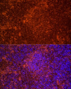 Invitrogen TLR7 Polyclonal Antibody 100 &mu;L; Unconjugated:Antibodies,