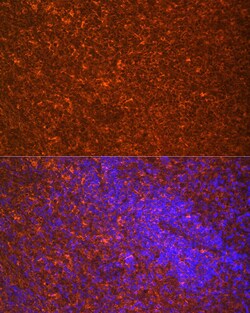Invitrogen TLR7 Polyclonal Antibody 100 &mu;L; Unconjugated:Antibodies,