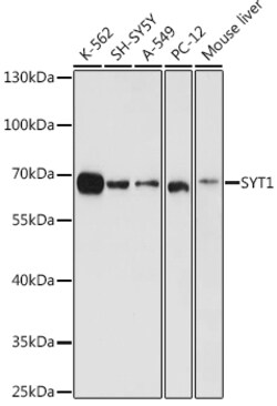 Invitrogen Synaptotagmin 1 Polyclonal Antibody 100 &mu;L | Buy Online | Invitrogen&trade; | Fisher Scientific