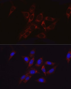 Invitrogen HK2 Polyclonal Antibody 100 &mu;L; Unconjugated:Antibodies,