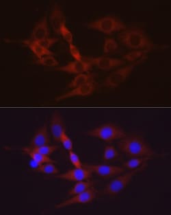 Invitrogen HK2 Polyclonal Antibody 100 &mu;L; Unconjugated:Antibodies,