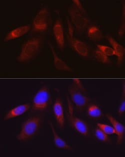 Invitrogen HK2 Polyclonal Antibody 100 &mu;L; Unconjugated:Antibodies,