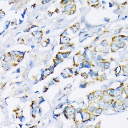 Invitrogen HK2 Polyclonal Antibody 100 &mu;L; Unconjugated:Antibodies,