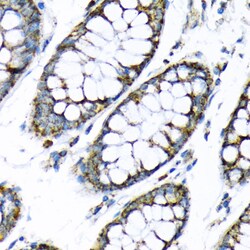 Invitrogen HK2 Polyclonal Antibody 100 &mu;L; Unconjugated:Antibodies,