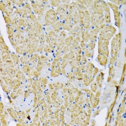 Invitrogen HK2 Polyclonal Antibody 100 &mu;L; Unconjugated:Antibodies,