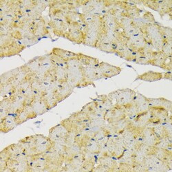 Invitrogen HK2 Polyclonal Antibody 100 &mu;L; Unconjugated:Antibodies,