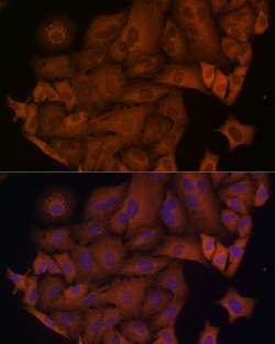 Invitrogen beta Arrestin 1 Polyclonal Antibody 100 &mu;L | Buy Online | Invitrogen&trade; | Fisher Scientific