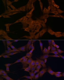 Invitrogen beta Arrestin 1 Polyclonal Antibody 100 &mu;L | Buy Online | Invitrogen&trade; | Fisher Scientific