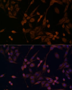 Invitrogen beta Arrestin 1 Polyclonal Antibody 100 &mu;L | Buy Online | Invitrogen&trade; | Fisher Scientific