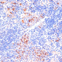 Invitrogen beta Arrestin 1 Polyclonal Antibody 100 &mu;L | Buy Online | Invitrogen&trade; | Fisher Scientific