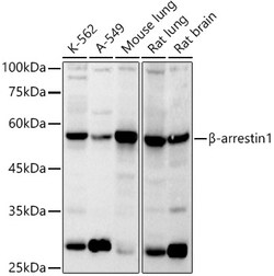Invitrogen beta Arrestin 1 Polyclonal Antibody 100 &mu;L | Buy Online | Invitrogen&trade; | Fisher Scientific