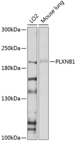Invitrogen PLXNB1 Polyclonal Antibody 100 &mu;L; Unconjugated:Antibodies,