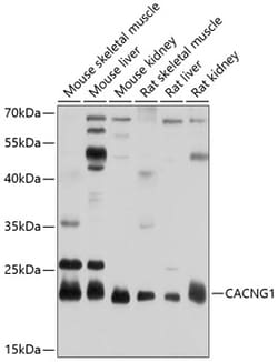 Invitrogen CACNG1 Polyclonal Antibody 100 &mu;L; Unconjugated:Antibodies,
