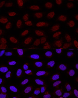 Invitrogen YAP1 Polyclonal Antibody 100 &mu;L; Unconjugated:Antibodies,