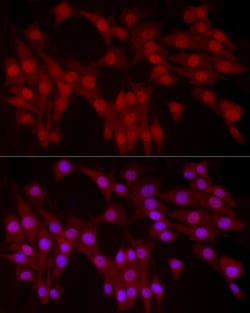 Invitrogen YAP1 Polyclonal Antibody 100 &mu;L; Unconjugated:Antibodies,