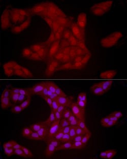 Invitrogen YAP1 Polyclonal Antibody 100 &mu;L; Unconjugated:Antibodies,