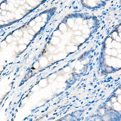 Invitrogen YAP1 Polyclonal Antibody 100 &mu;L; Unconjugated:Antibodies,