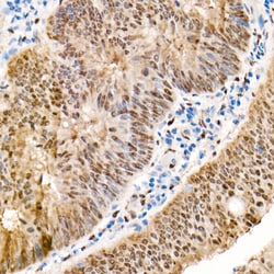 Invitrogen YAP1 Polyclonal Antibody 100 &mu;L; Unconjugated:Antibodies,