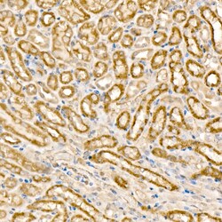 Invitrogen MCCC1 Polyclonal Antibody 100 &mu;L; Unconjugated:Antibodies,