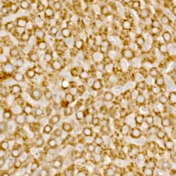 Invitrogen MCCC1 Polyclonal Antibody 100 &mu;L; Unconjugated:Antibodies,