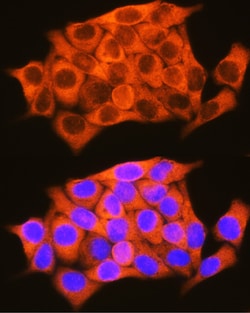 Invitrogen RBP1 Polyclonal Antibody 100 &mu;L; Unconjugated:Antibodies,
