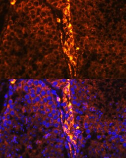 Invitrogen RBP1 Polyclonal Antibody 100 &mu;L; Unconjugated:Antibodies,